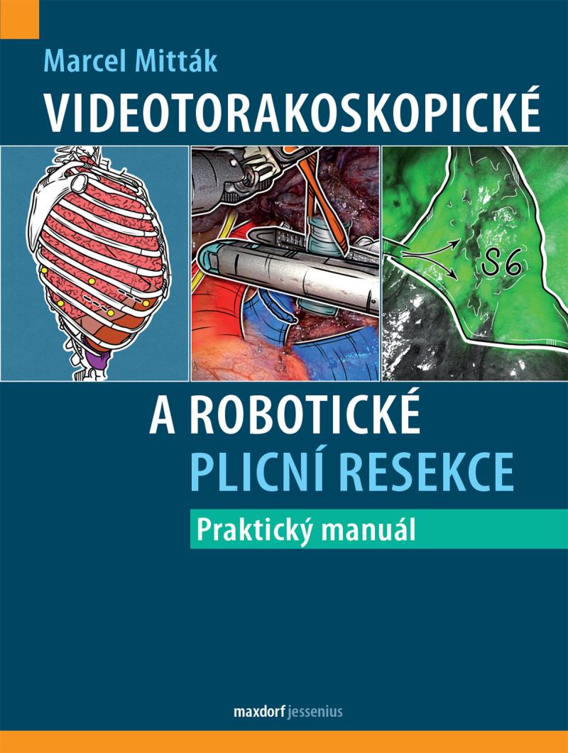 Videotorakoskopick� a robotick� plicn� resekce 