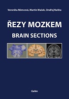 �ezy mozkem