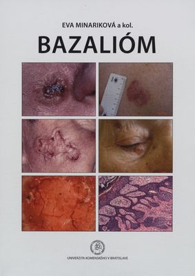 Bazali�m
