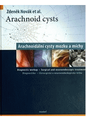 Arachnoid cysts