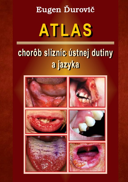 Atlas chor�b slizn�c �stnej dutiny a jazyka