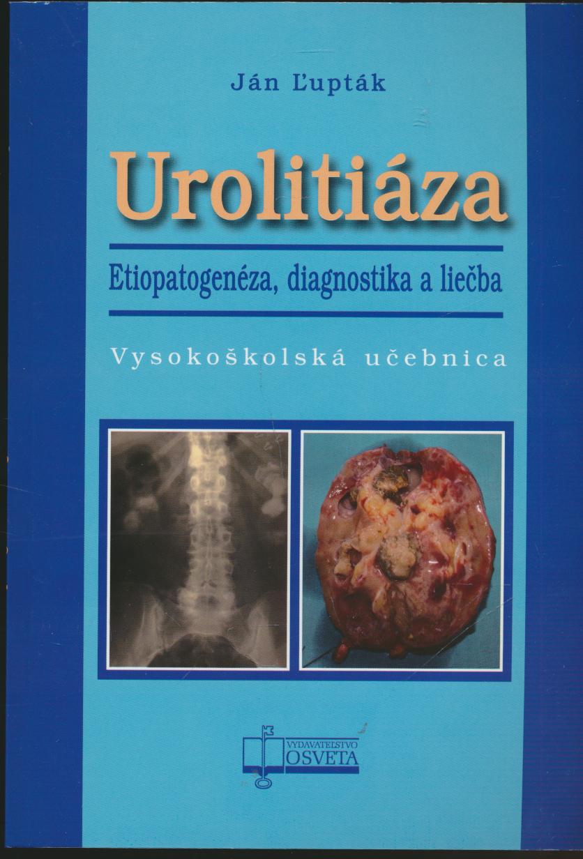 Uroliti�za. Etiopatogen�za, diagnostika a lie�ba