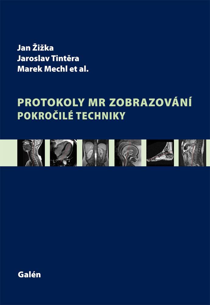 Protokoly v MR zobrazov�n� pokro. tech.