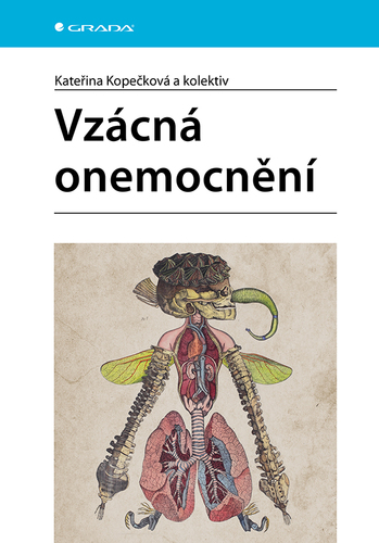 Vz�cn� onemocn�n�