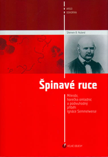 �pinav� ruce