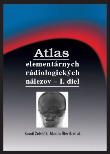 Atlas element�rnych r�diologick�ch n�lezov - I. diel (2.vydanie)