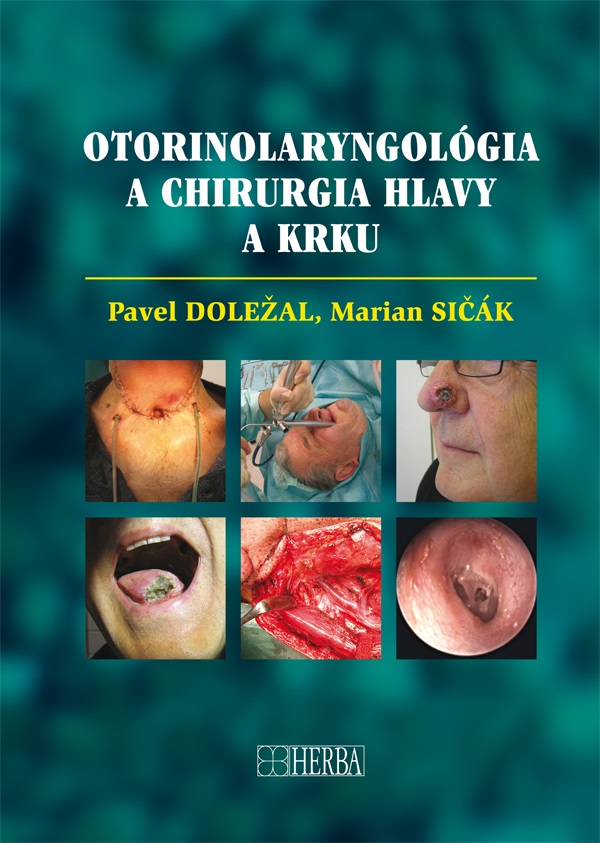 Otorinolaryngol�gia a chirurgia hlavy a krku