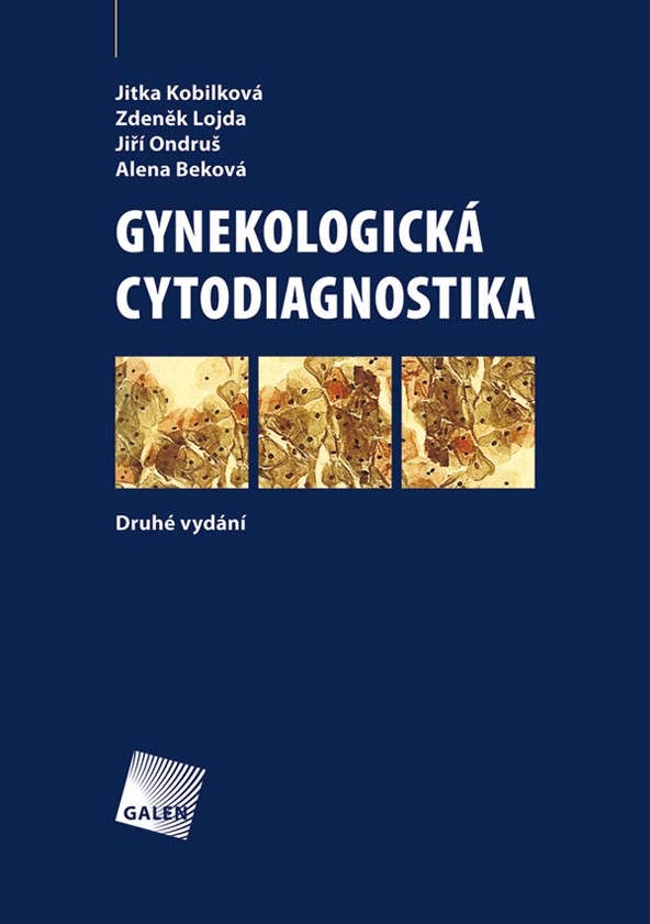 Gynekologick� cytodiagnostika