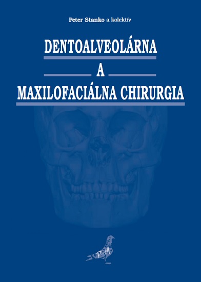 Dentoalveol�rna a maxilofaci�lna chirurgia