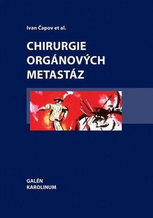 Chirurgie org�nov�ch metast�z