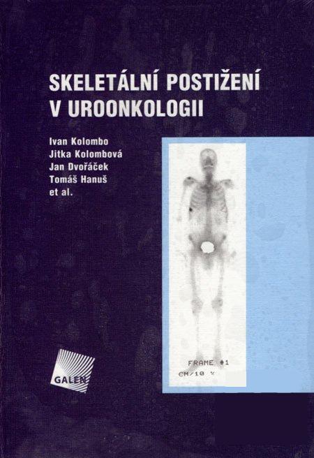 Skelet�ln� posti�en� v uroonkologii
