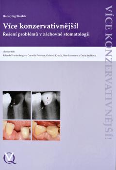 V�ce konzervativn�j��!