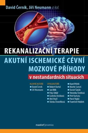 Rekanaliza�n� terapie akutn� ischemick� c�vn� mozkov� p��hody v nestandardn�ch situac�ch