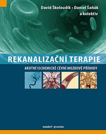 Rekanaliza�n� terapie