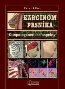 Karcin�m prsn�ka