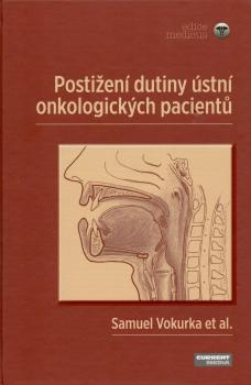 Posti�en� dutiny �stn� onkologick�ch pacient�