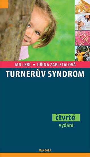 Turner�v syndrom 4v.