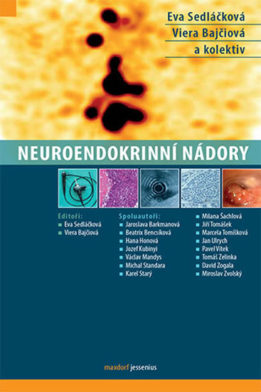 Neuroendokrinn� n�dory