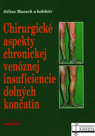 Chirurgick� aspekty chronickej ven�znej insuficiencie doln�ch kon�at�n
