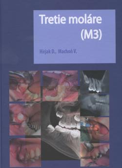 Tretie mol�re (M3)