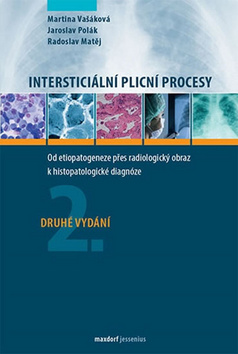 Interstici�ln� plicn� procesy, 2. vyd�n�