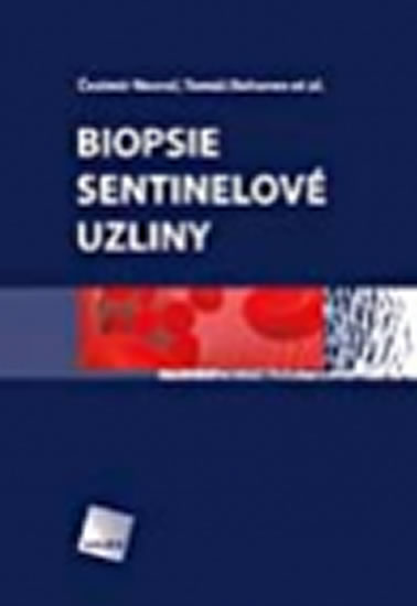 Biopsie sentinelov� uzliny