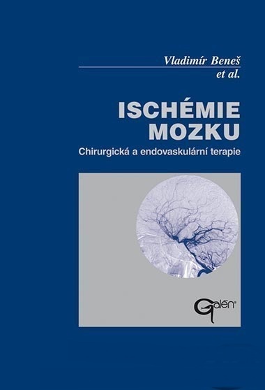 Isch�mie mozku
