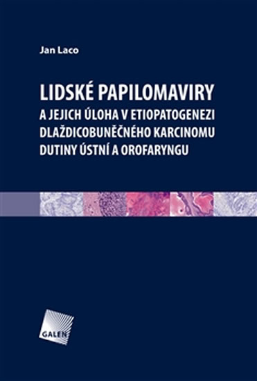 Lidsk� papilomaviry a jejich �loha v etiopatogenezi dla�dicobun��n�ho karcinomu dutiny �stn� a orofa