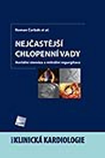 Nej�ast�j�� chlopenn� vady