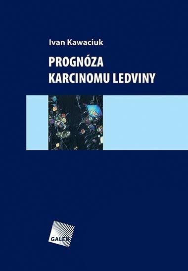 Progn�za karcinomu ledviny