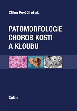 Patomorfologie chorob kost� a kloub�