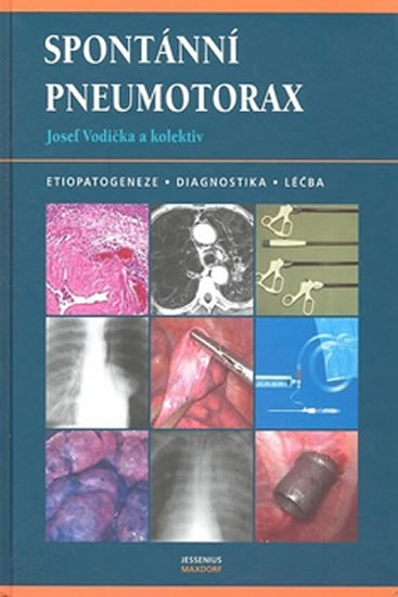 Spont�nn� pneumotorax