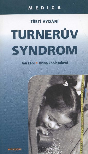 Turner�v syndrom