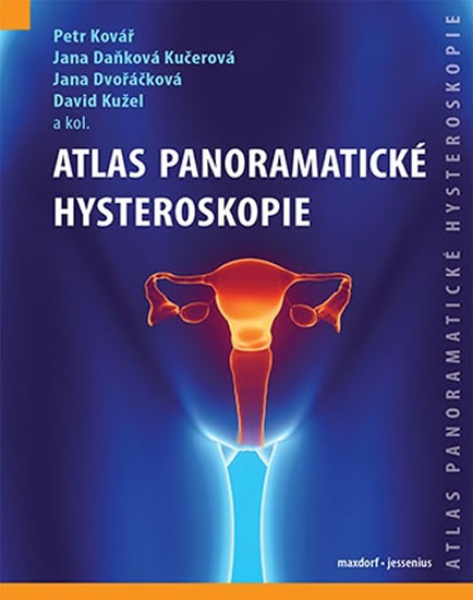 Atlas panoramatick� hysteroskopie