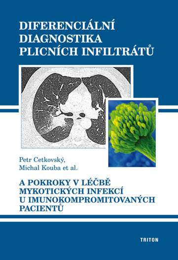 Diferenci�ln� diagnostika plicn�ch infiltr�t�