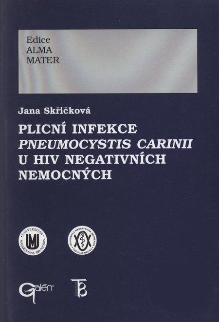 Plicn� infekce Pneumocystis carinii u HIV negativn�ch nemocn�ch