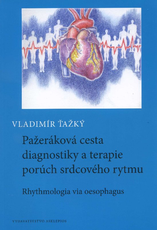 Pa�er�kov� cesta diagnostiky a terapie por�ch srdcov�ho rytmu