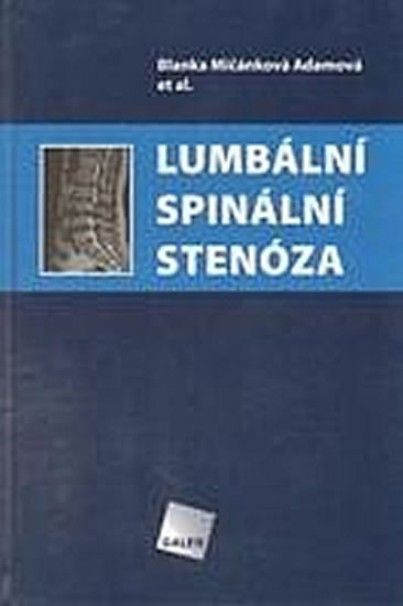 Lumb�ln� spin�ln� sten�za