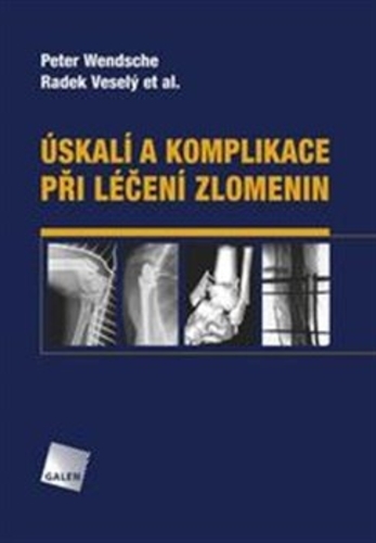 �skal� a komplikace p�i l��en� zlomenin