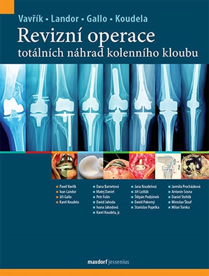 Revizn� operace tot�ln�ch n�hrad kolenn�ho kloubu