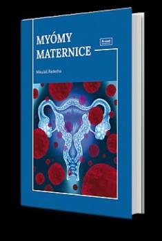 My�my maternice