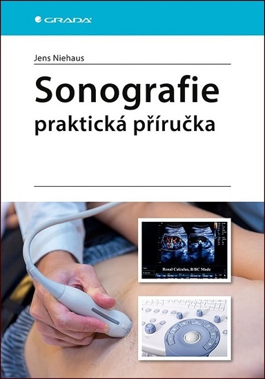 Sonografie Praktick� p��ru�ka