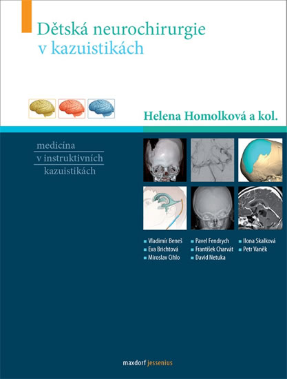 D�tsk� neurochirurgie v kazuistik�ch