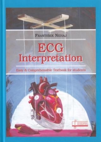 ECG Interpretation