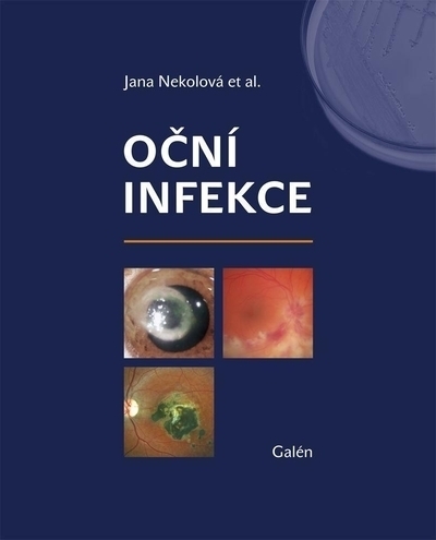 O�n� infekce