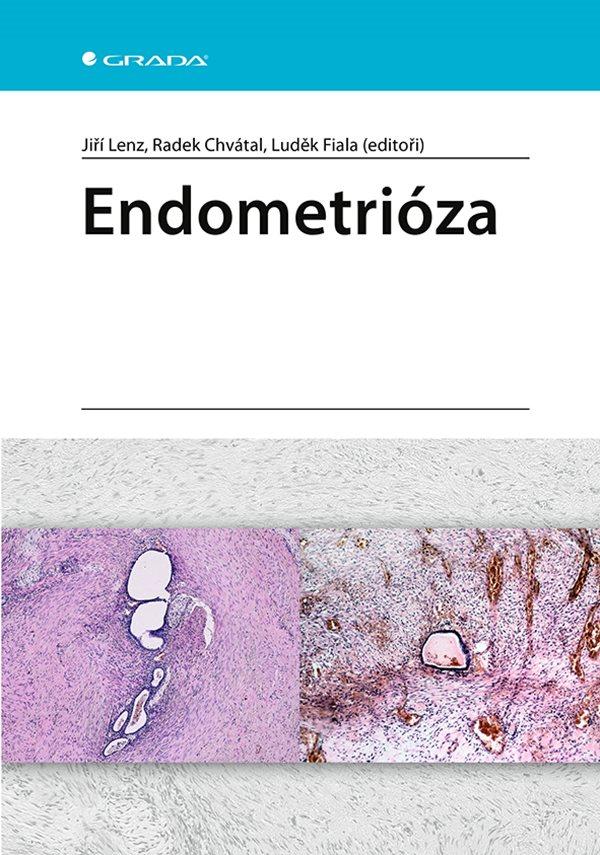 Endometri�za GRADA
