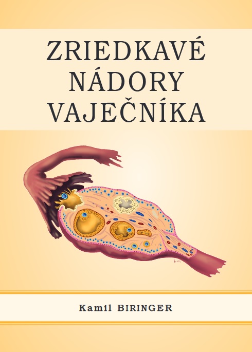 Zriedkav ndory vajenka