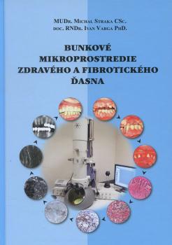 Bunkov� mikroprostredie zdrav�ho a fibrotick�ho �asna