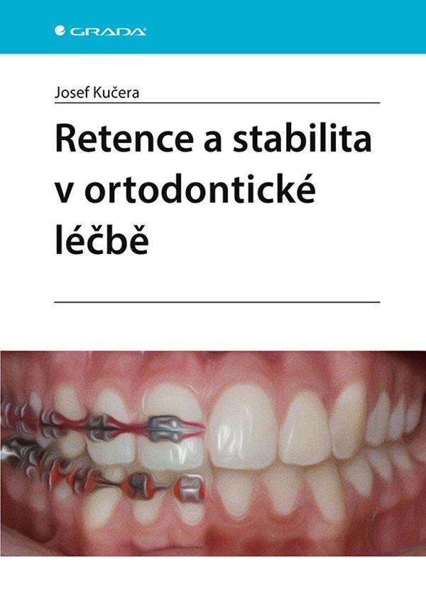 Retence a stabilita v ortodontick� l��b�