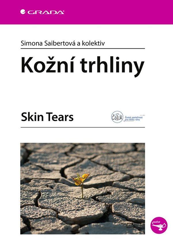Ko�n� trhliny
